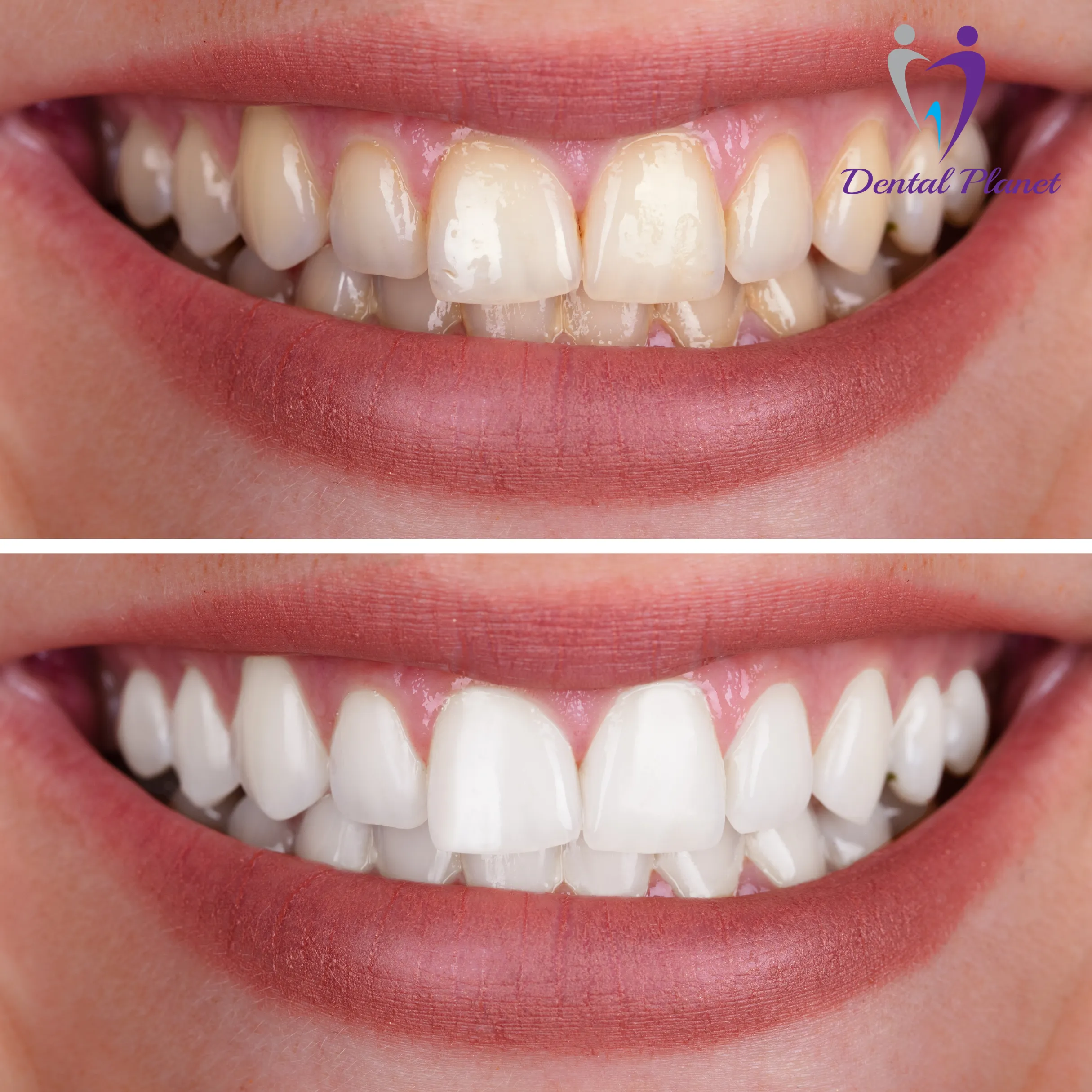 Best Dentist in Mysore